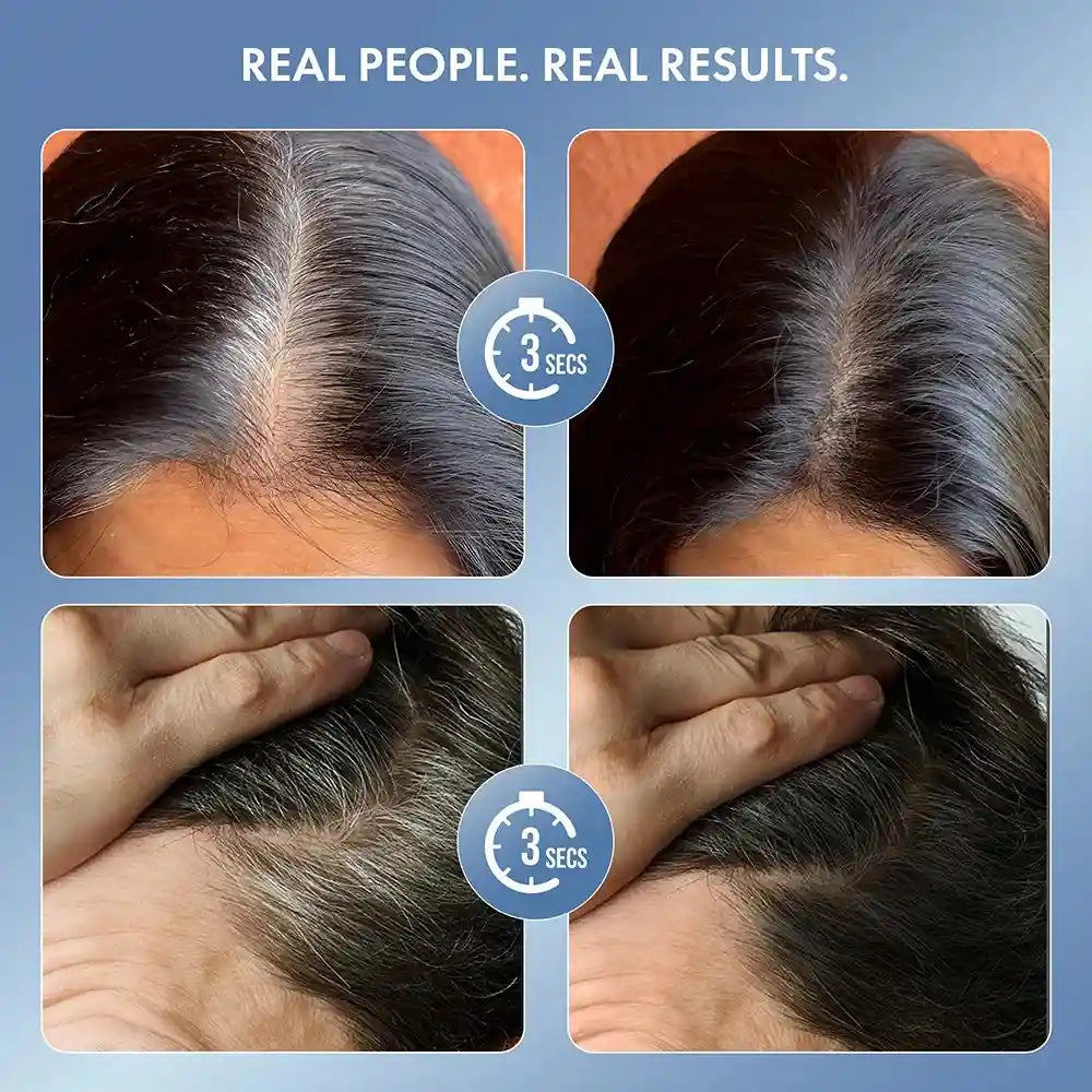 customer showing results after using thriveco cover up hair powder