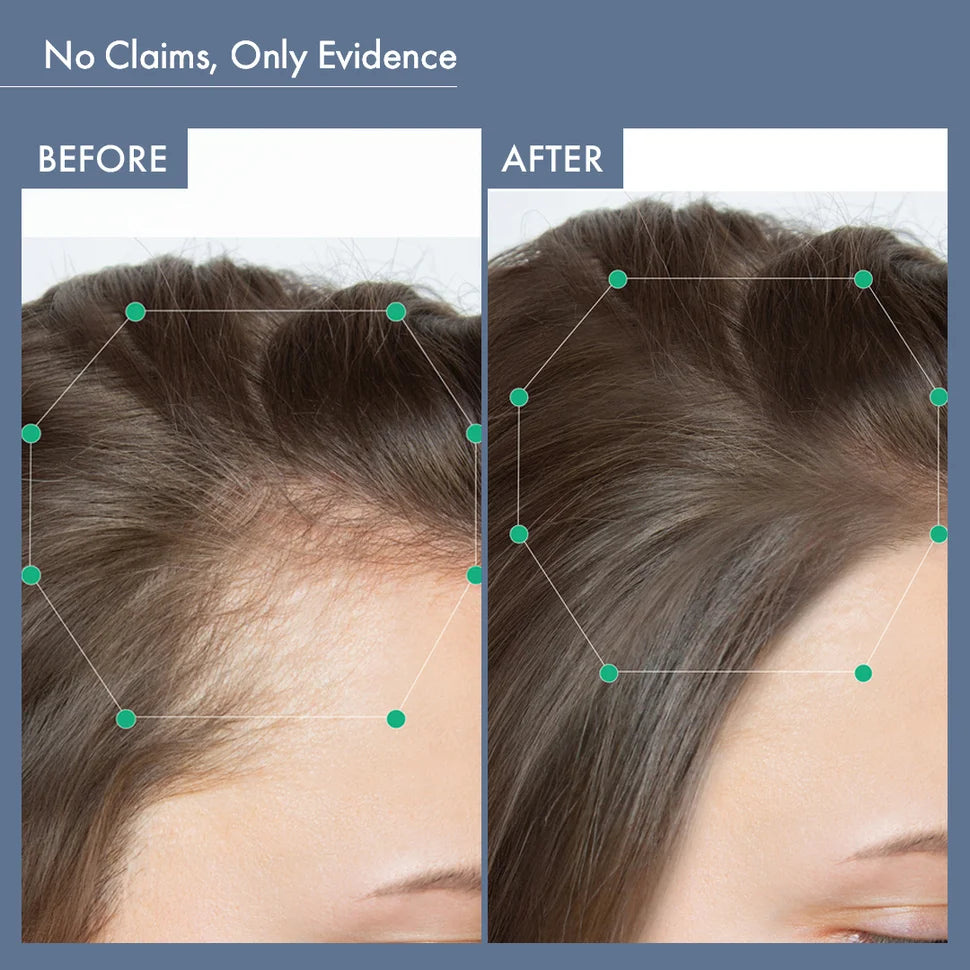 Before & After Image of Using ThriveCo Hair Growth Supplement for Women