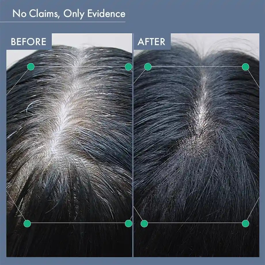 Women’s Post-Partum Hair Growth Solution