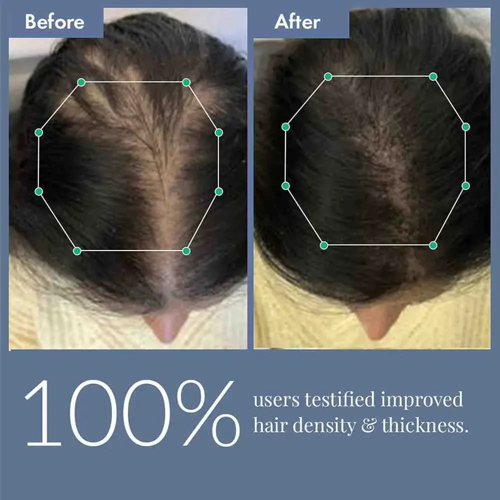 Hair Growth Serum 2.0 For Men & Women