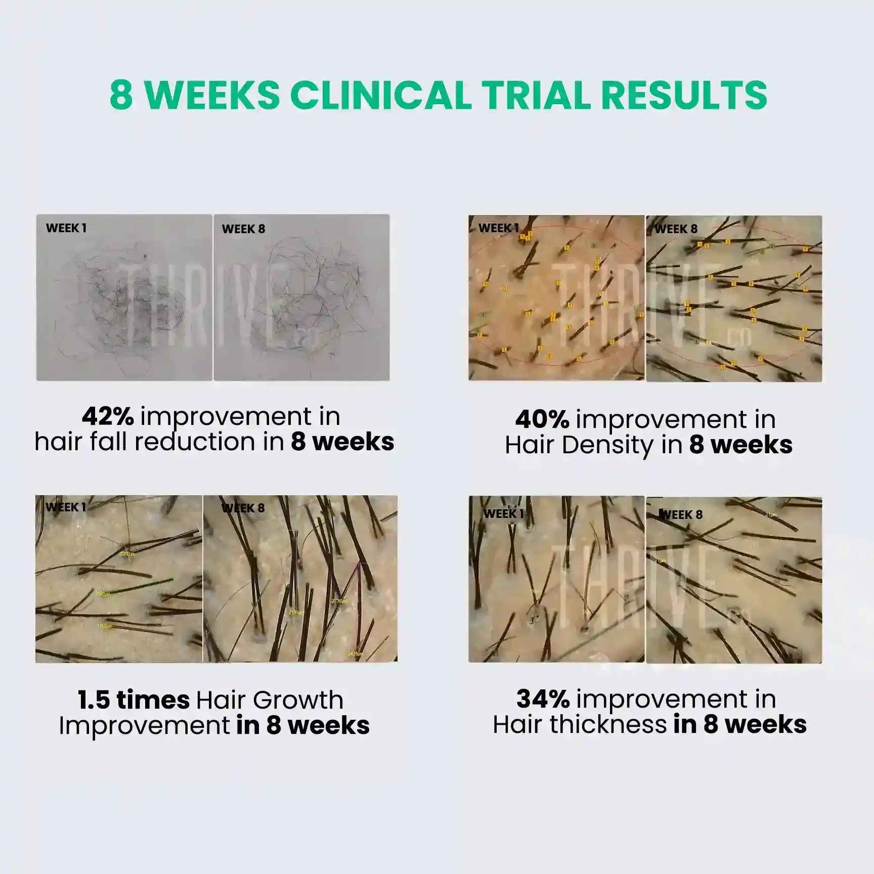 8 weeks clinical trail results of thriveco hair growth serum