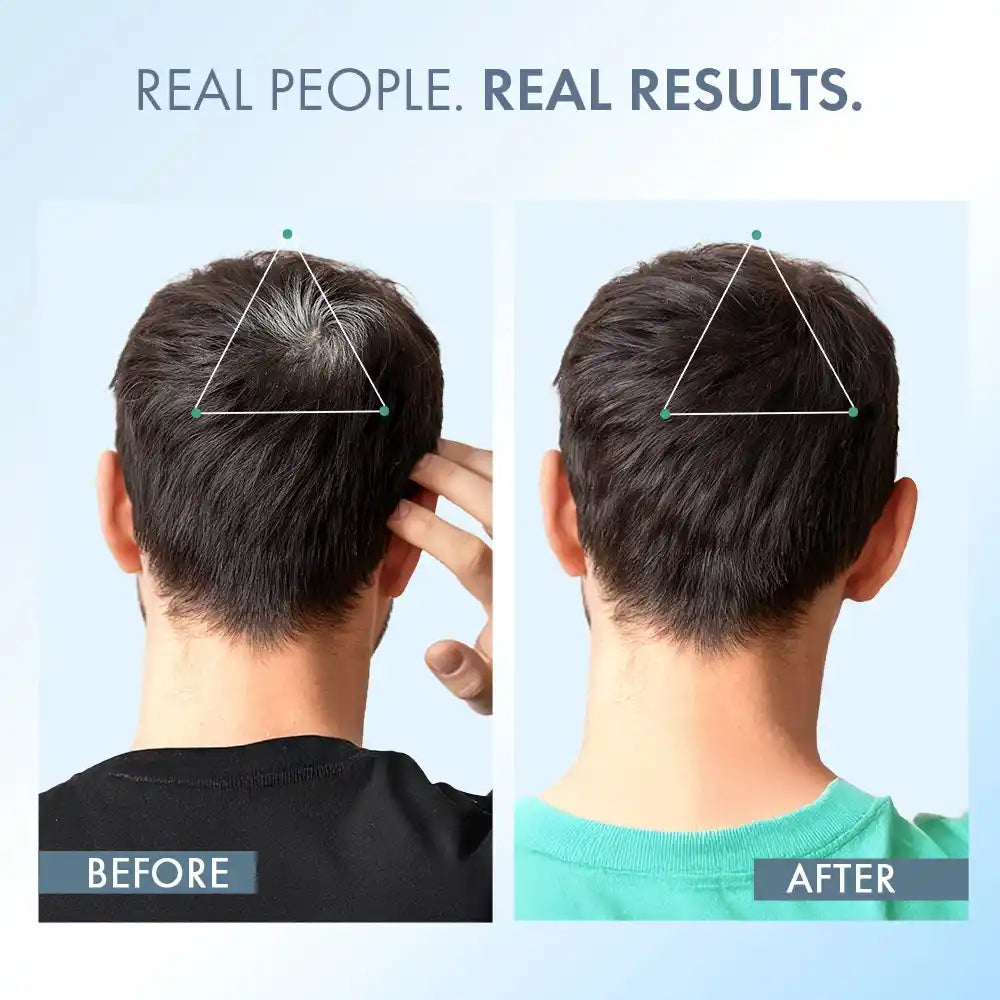 Anti-Grey Hair Prime Serum, 50 ml + Supplements 30N