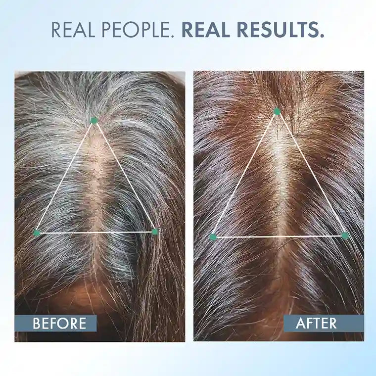 Anti-Grey Hair Prime Serum, 50 ml + Supplements 30N