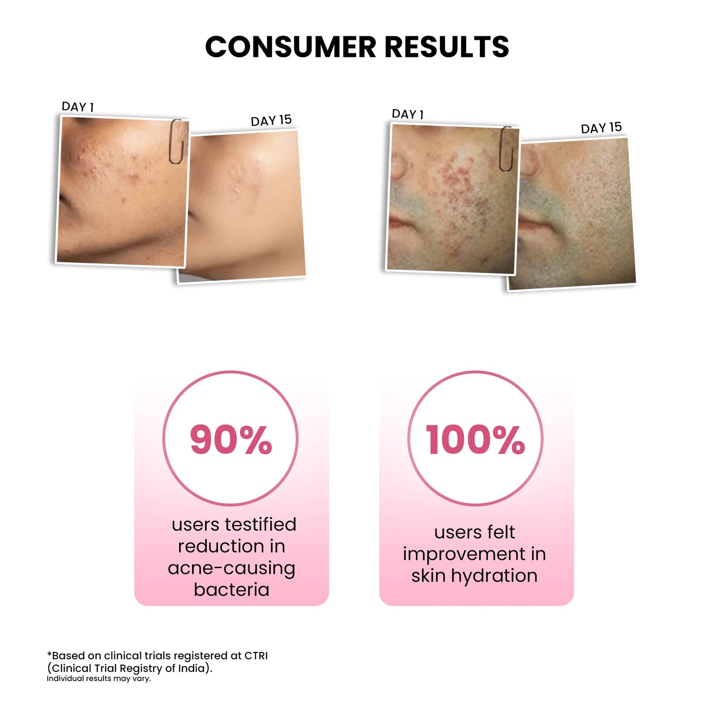 Goodbye Acne Trial Kit