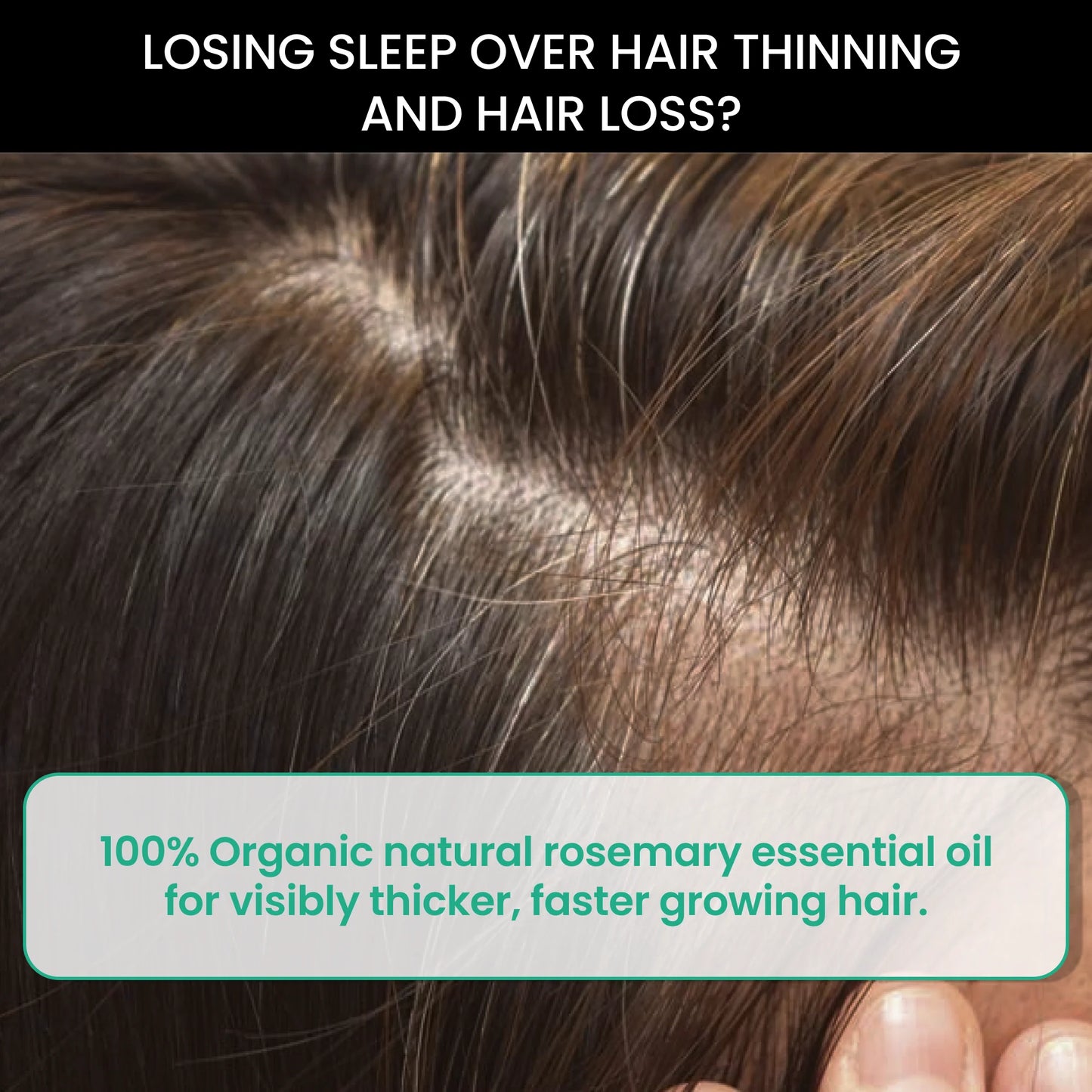 Rosemary Essential Oil for Hair Loss