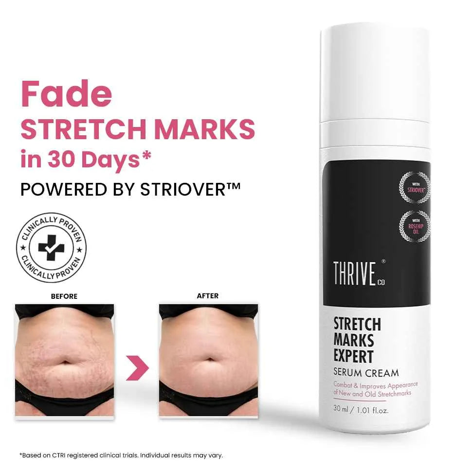 Stretch Marks Expert, Serum Cream, 30ml
