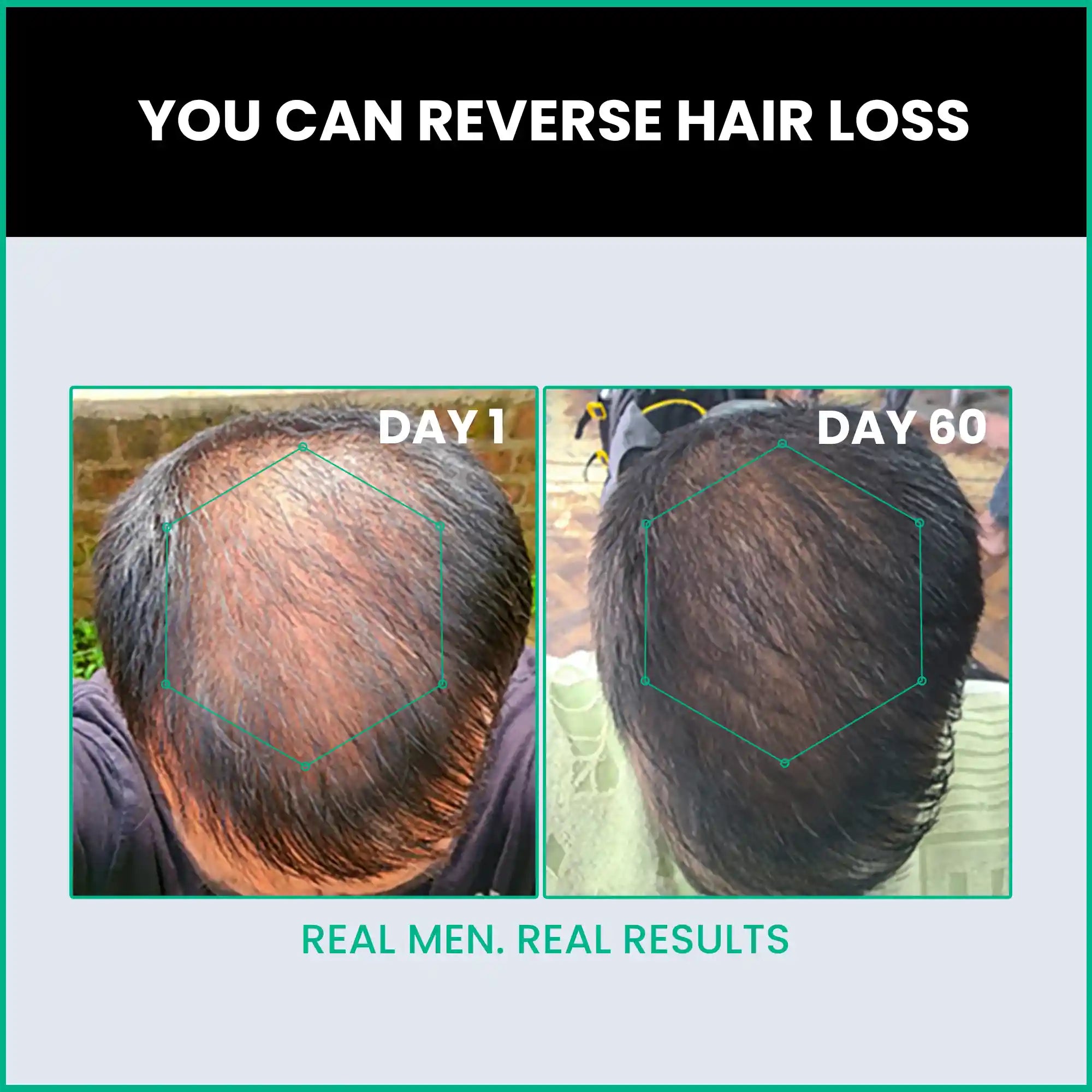 reverse hair loss in 60 days with hair growth serum for men