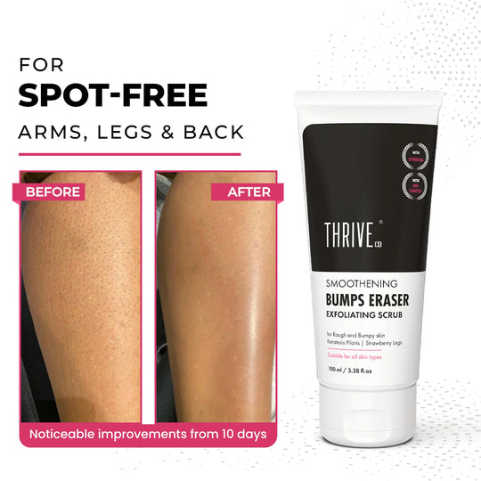 Detailed Review of ThriveCo 
Bumps Smoothening Eraser Exfoliating Scrub