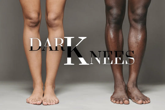 Dark Knees