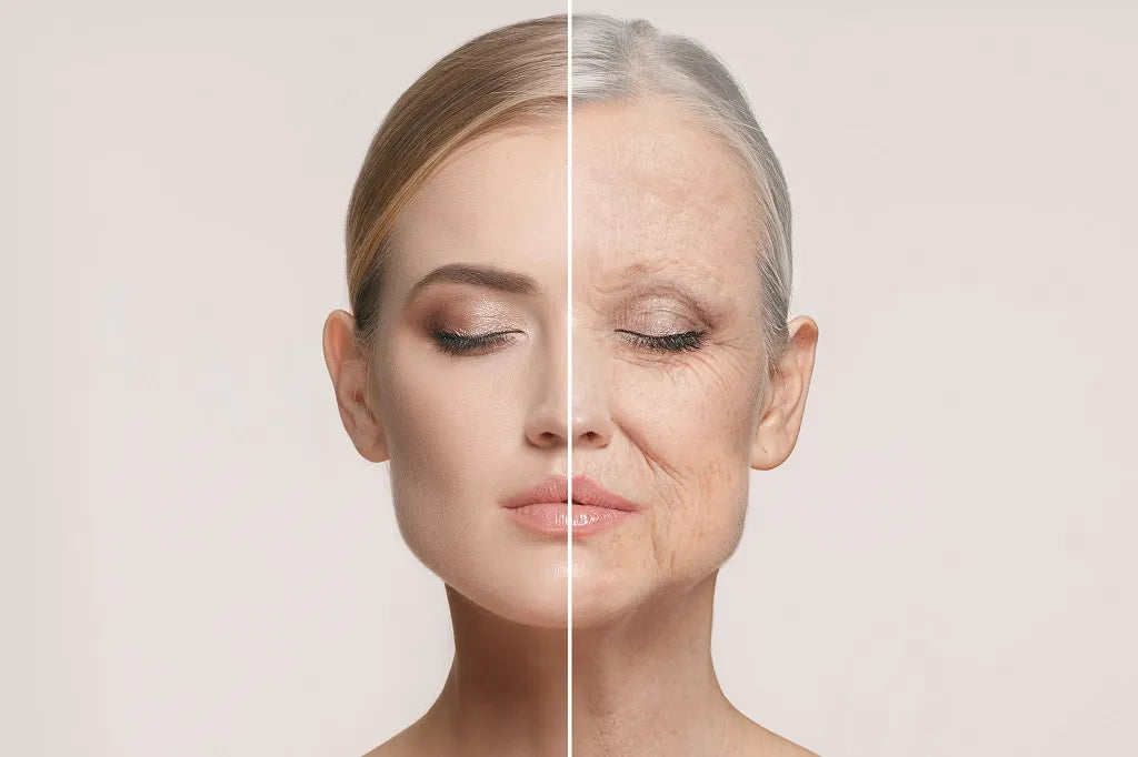 Can Wrinkles Be Reversed