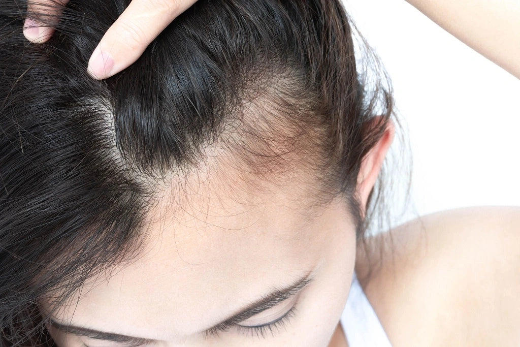 Biotin For Hair Growth