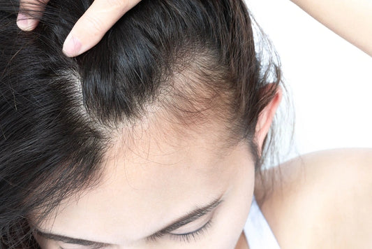 Biotin For Hair Growth