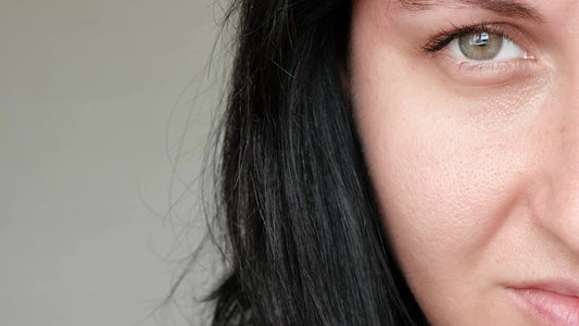 Enlarged Pores