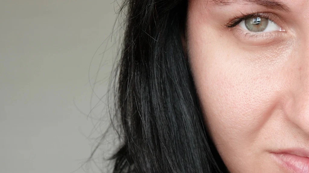 Enlarged Pores