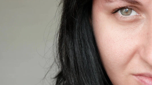 Enlarged Pores