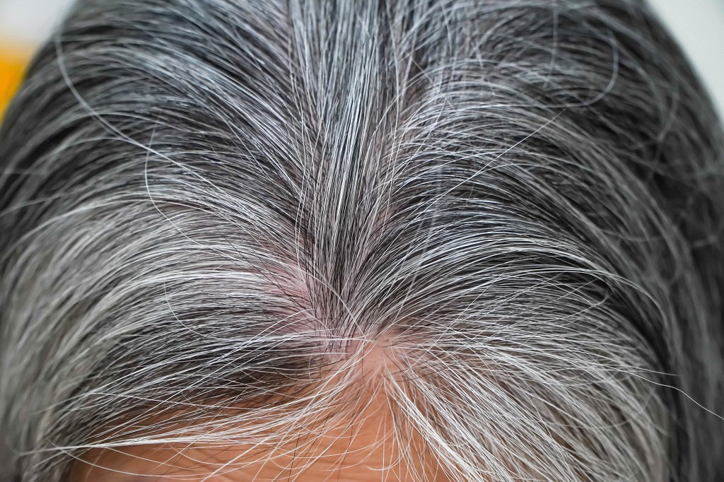 Premature greying of hair