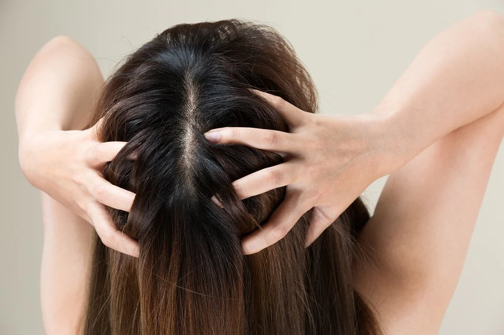 Scalp Build-Up