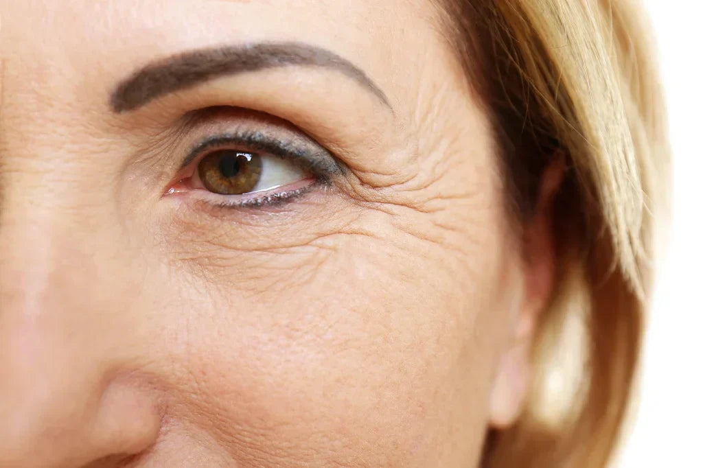 Wrinkles 