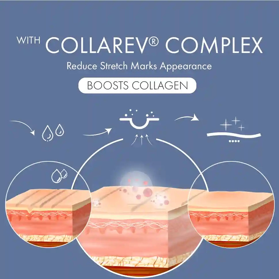 Stretch Marks Expert, Serum Cream 30ml