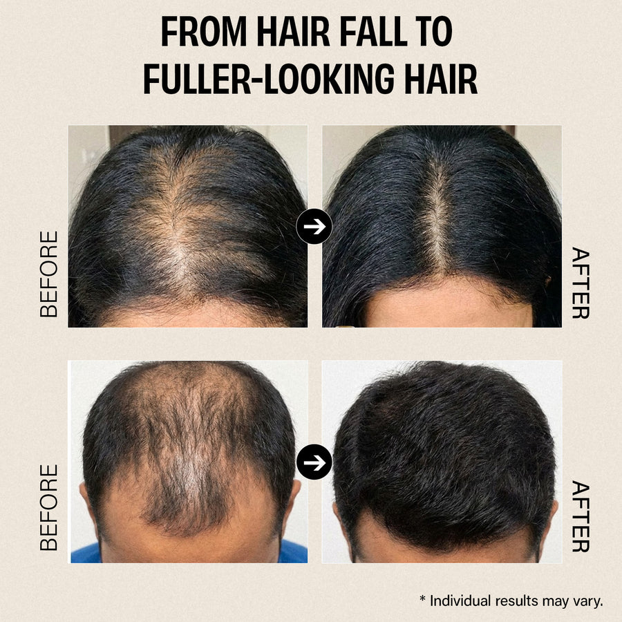 Anti Hair Fall Combo Rosemary shampoo + Rosemary Conditioner + Rosemary essential oil + Hair Growth Serum