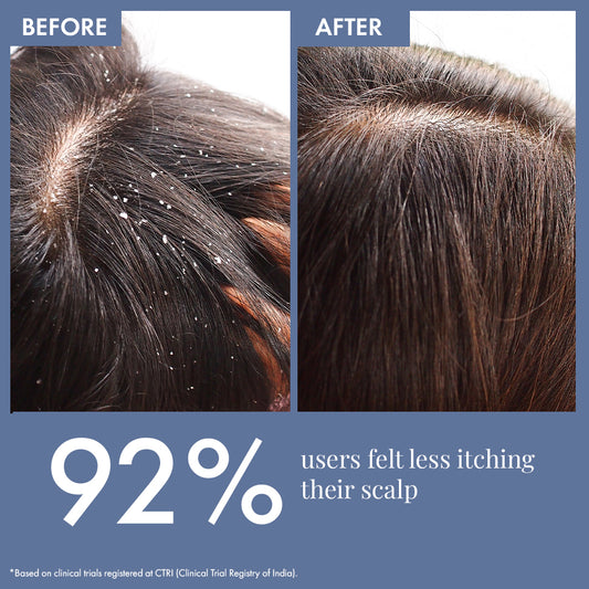 Scalp Clear Shampoo, 250ml + Exclusive Scalp clear conditioner, 250ml