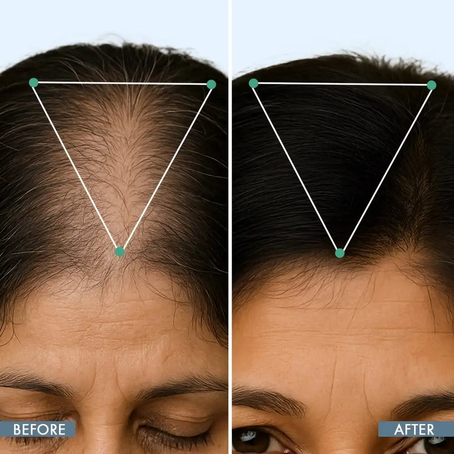 Hair Growth Serum, 50ml + Women's Hair Growth Supplement, 60N + Women's Balance Hair Supplement, 30N