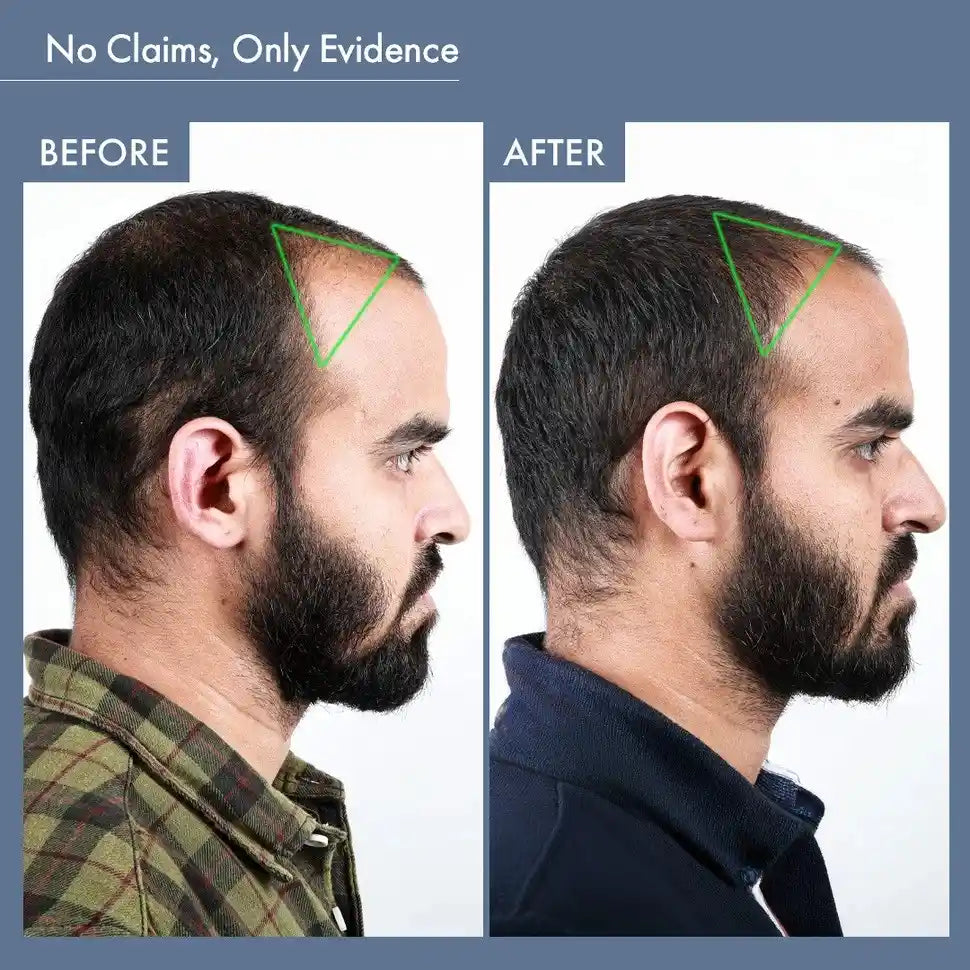 Men's Hair Growth Supplement, 60N Capsules