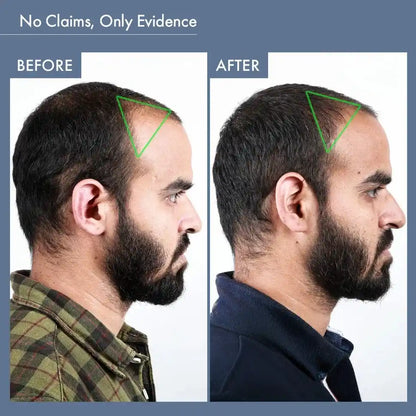 Men's Hair Growth Supplement, 60N Capsules