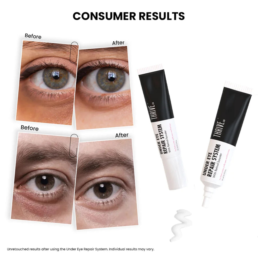 ThriveCo Undereye Repair System, 15 gms