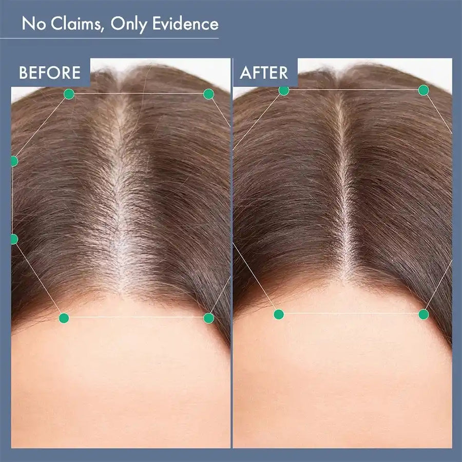 Hair Growth Serum, 50ml + Women's Post Partum Hair Growth Supplement, 60N