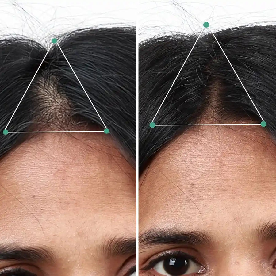 Hair Growth Serum, 50ml + Women's Hair Growth Supplement, 60N + Women's Balance Hair Supplement, 30N