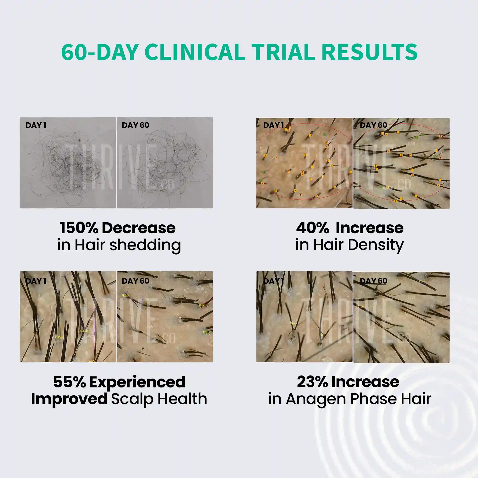 60 day clinical trial results of thriveco hair growth serum for men