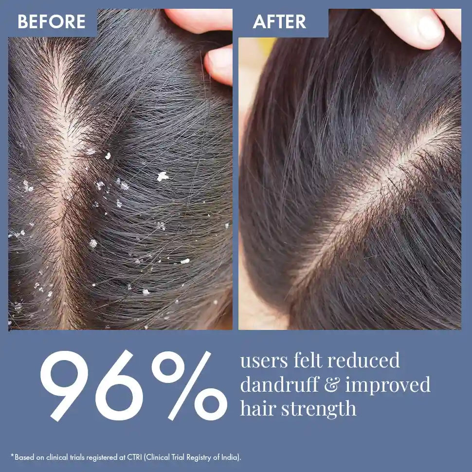 Scalp Clear Shampoo