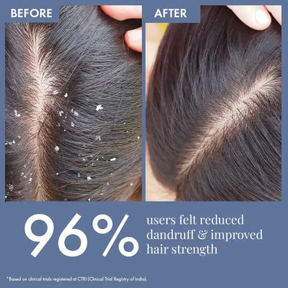 Scalp Clear Shampoo