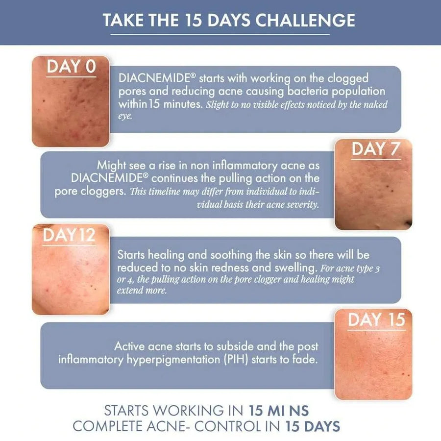 Goodbye Acne Cleanser & Acne Serum