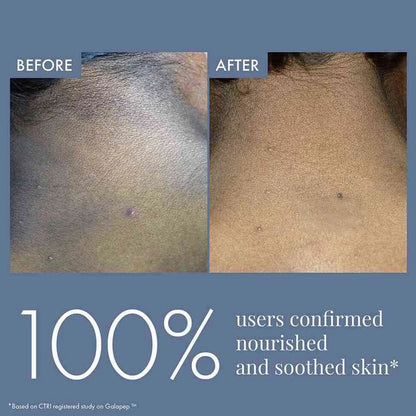 Dark Patches Corrector for Men & Women, 100ml