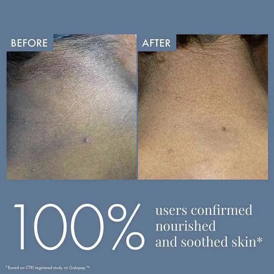 Dark Patches Corrector for Men & Women, 100ml