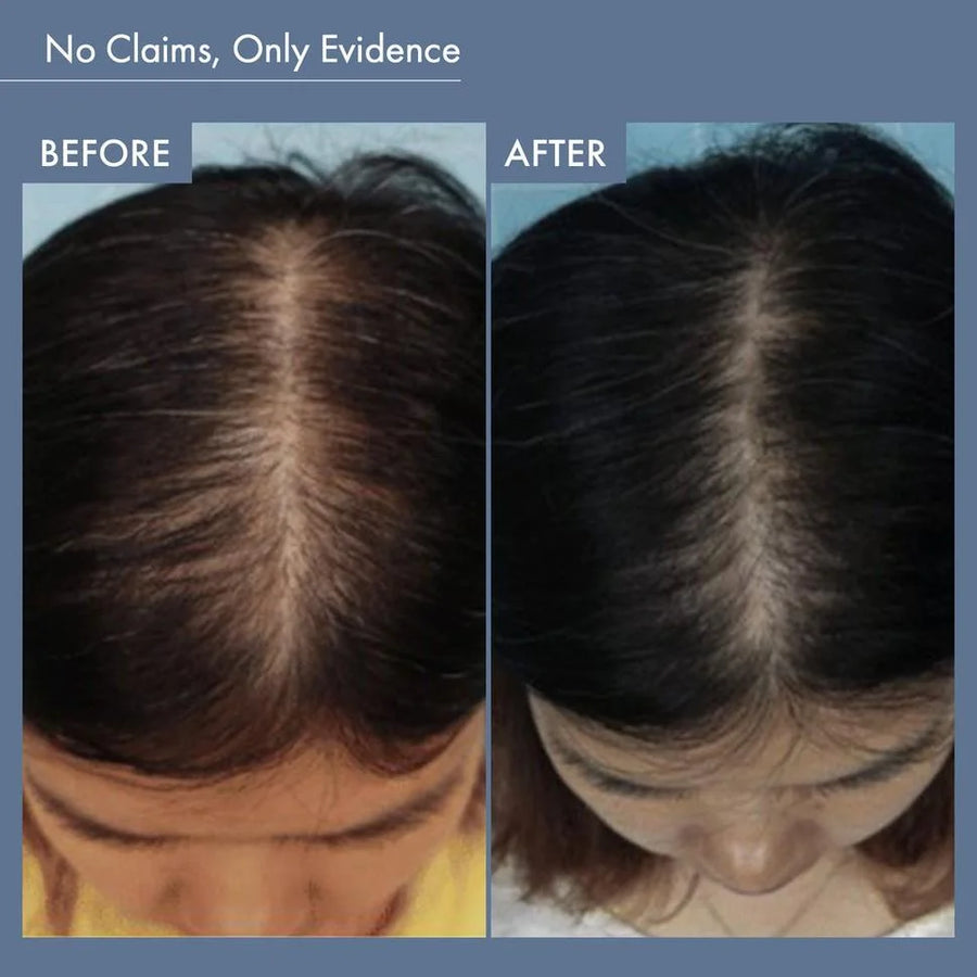 Rosemary Shampoo (250ml) + Rosemary Conditioner Combo (250ml)