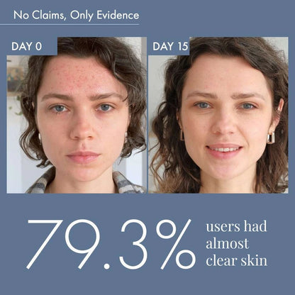 Goodbye Acne Cleanser (100ml) & Acne Serum (30ml)