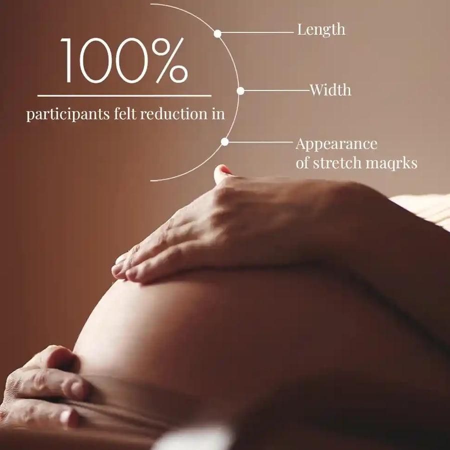 Stretch Marks Expert, Serum Cream 30ml