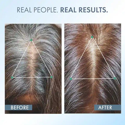 Anti-Grey Hair Prime Serum, 50 ml + Supplements 30N