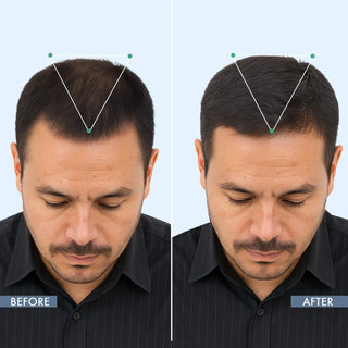 customer showing result after using thriveco hair root touch up powder