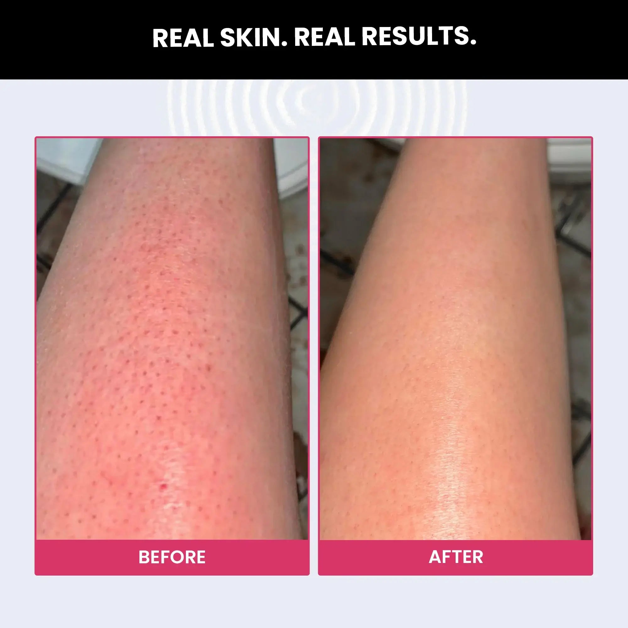 Exfoliating scrub for online legs