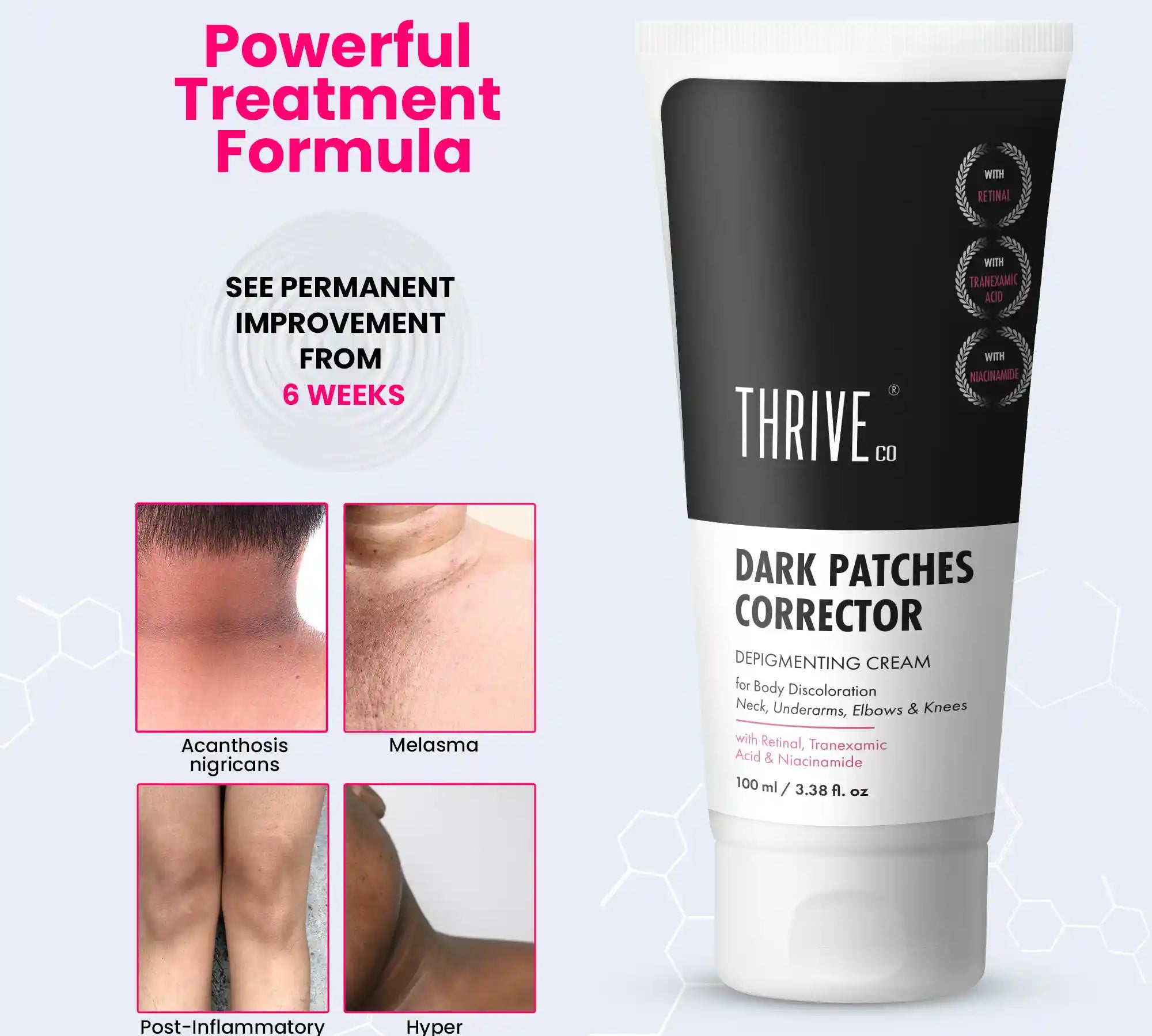 dark spots removal cream
