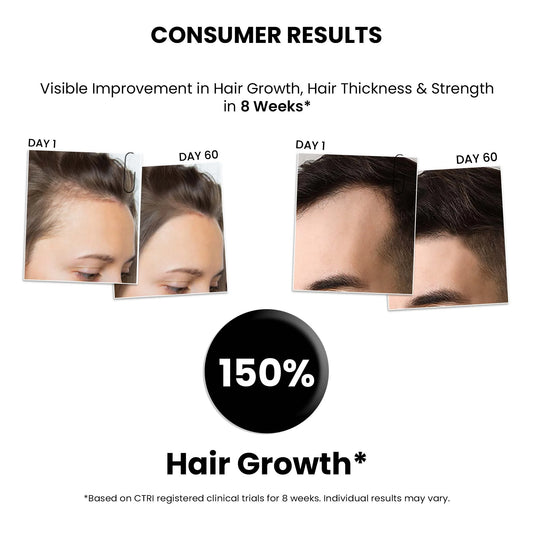 Hair Growth Serum for Men & Women 2.0, 30ML