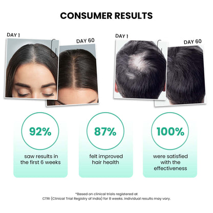  Serum for grey and white hair with anti-greying properties 