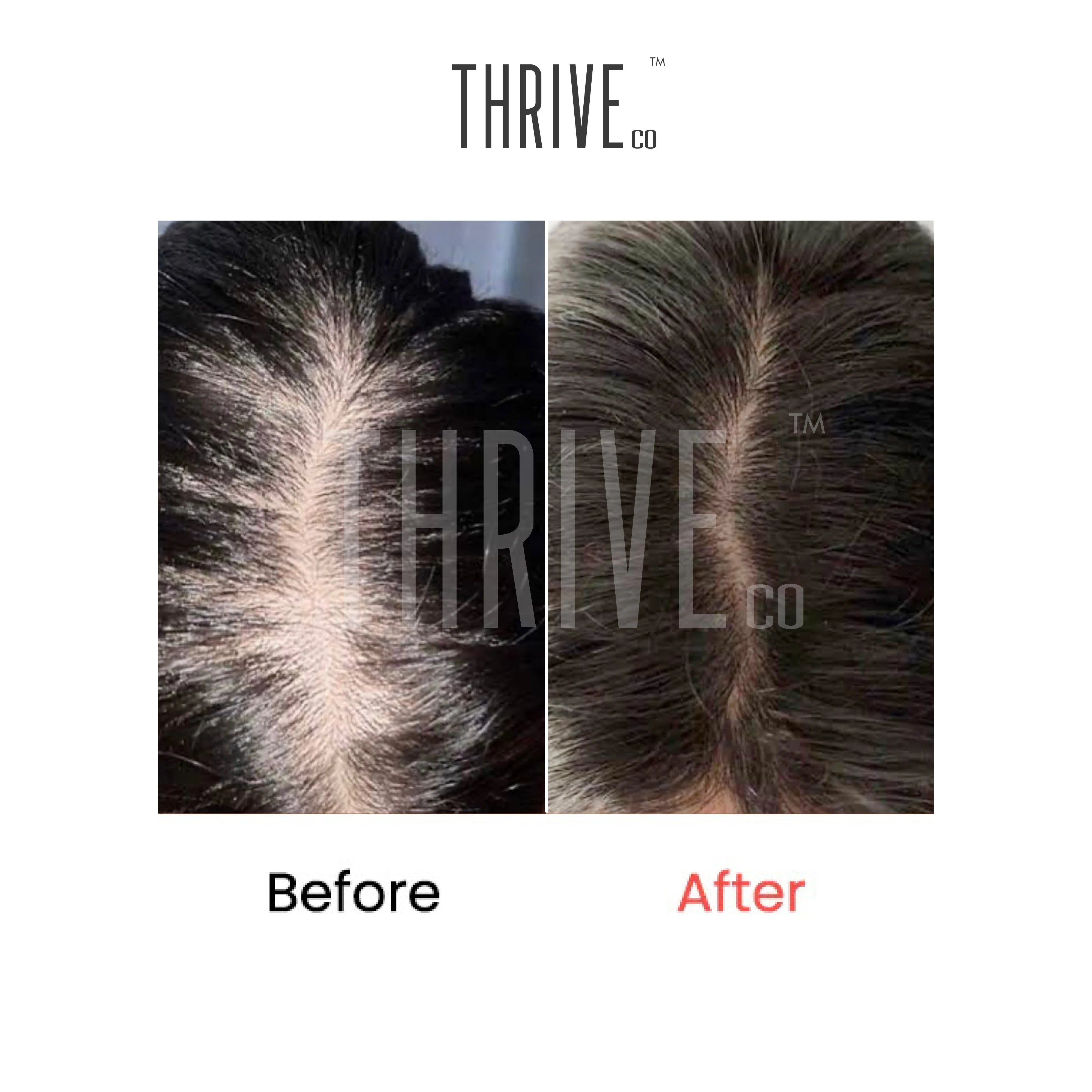 ThriveCo Hair Growth Serum (50ml) + ThriveCo Scalp Exfoliating Scrub (100ml)