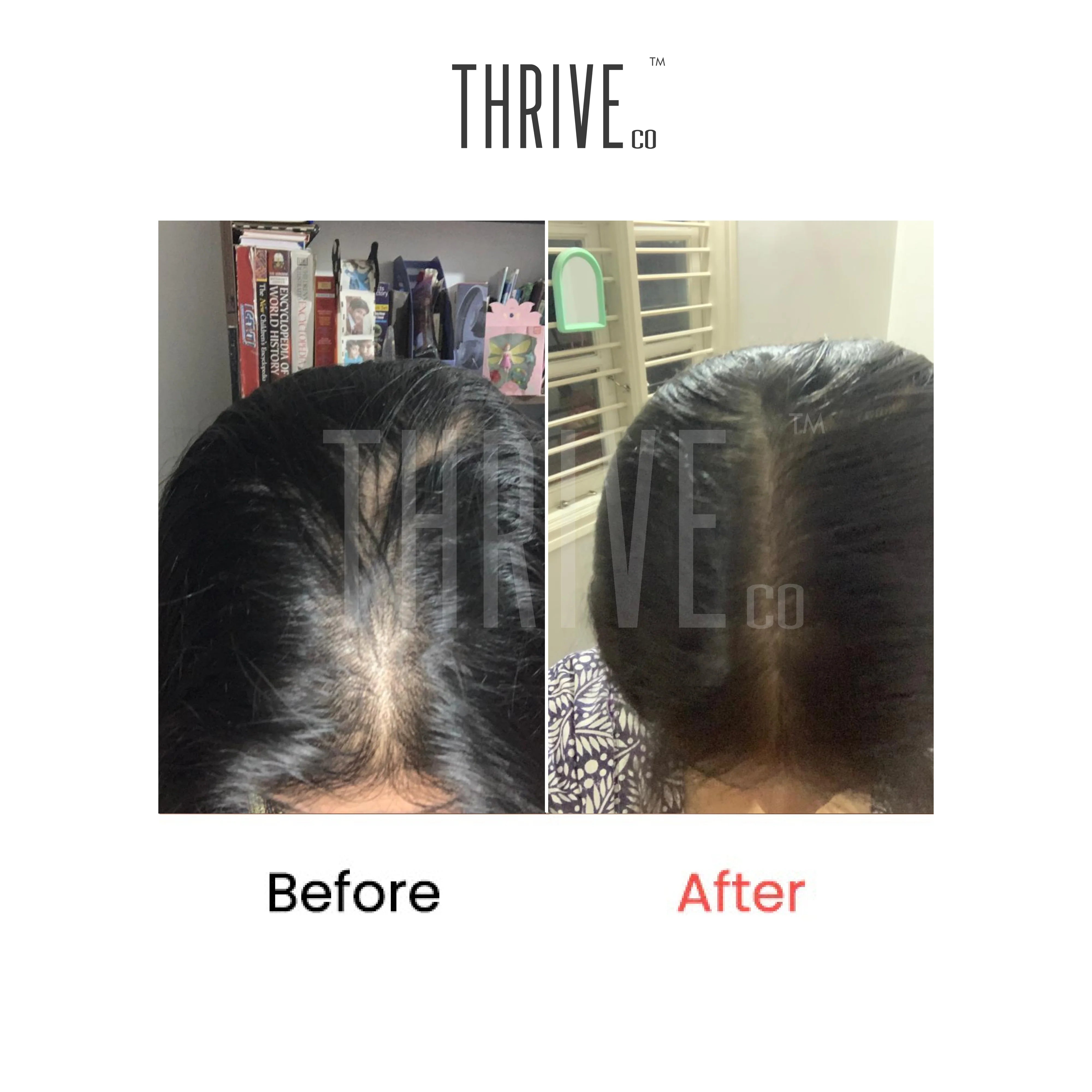 ThriveCo Hair Growth Serum (50ml) + ThriveCo Scalp Exfoliating Scrub (100ml)