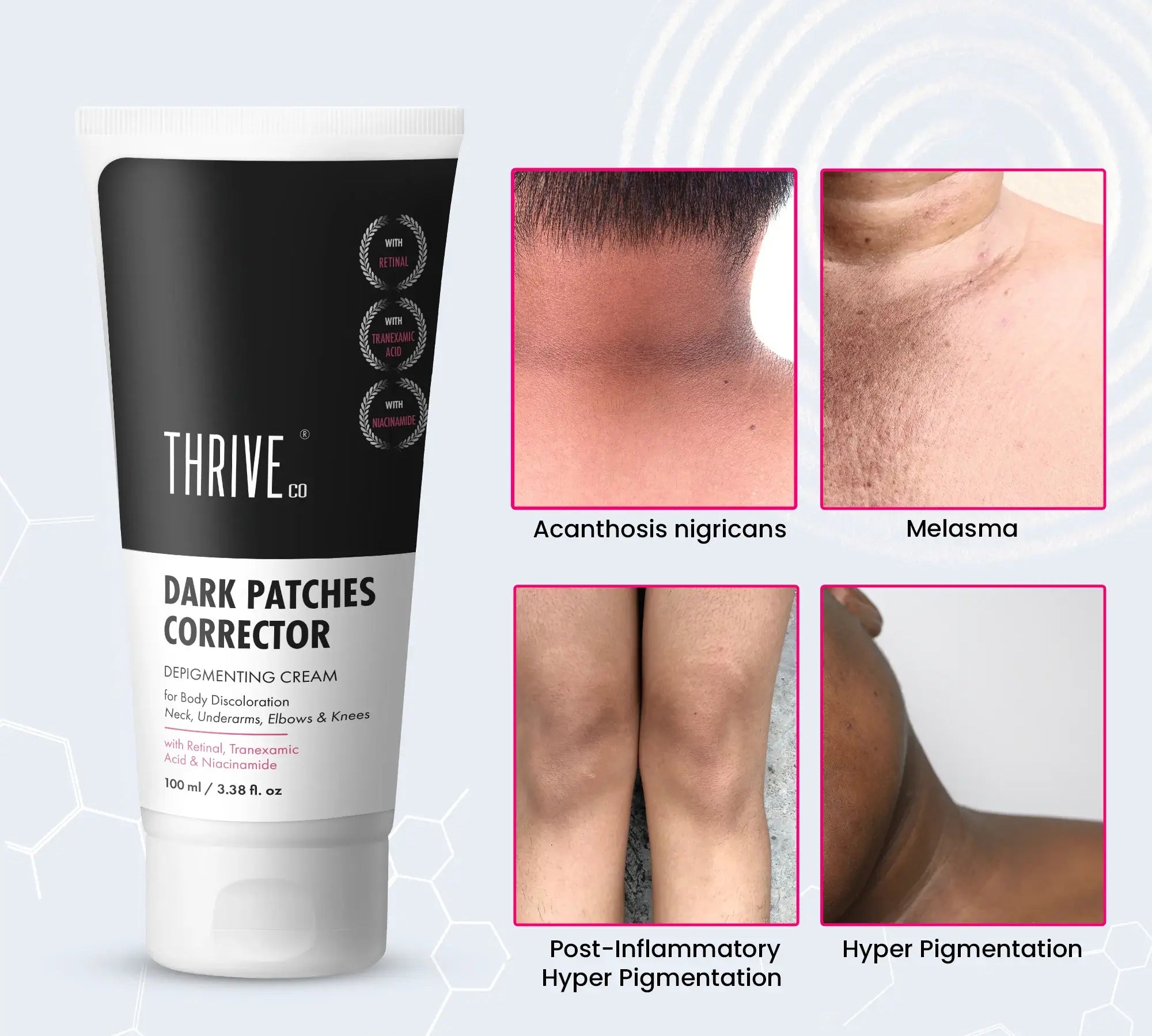 ThriveCo Dark Patches Corrector Depigmenting Cream