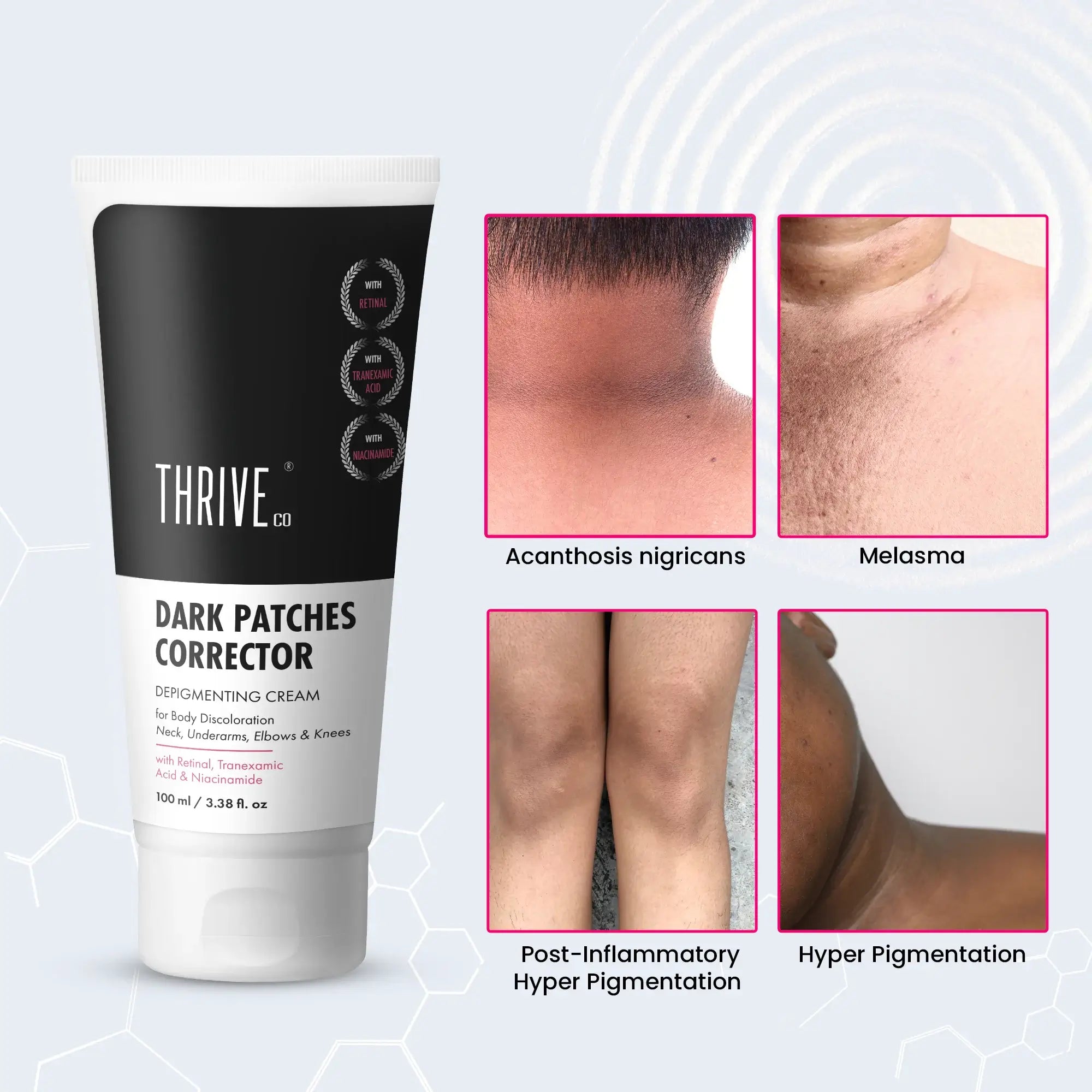 ThriveCo Dark Patches Corrector Depigmenting Cream